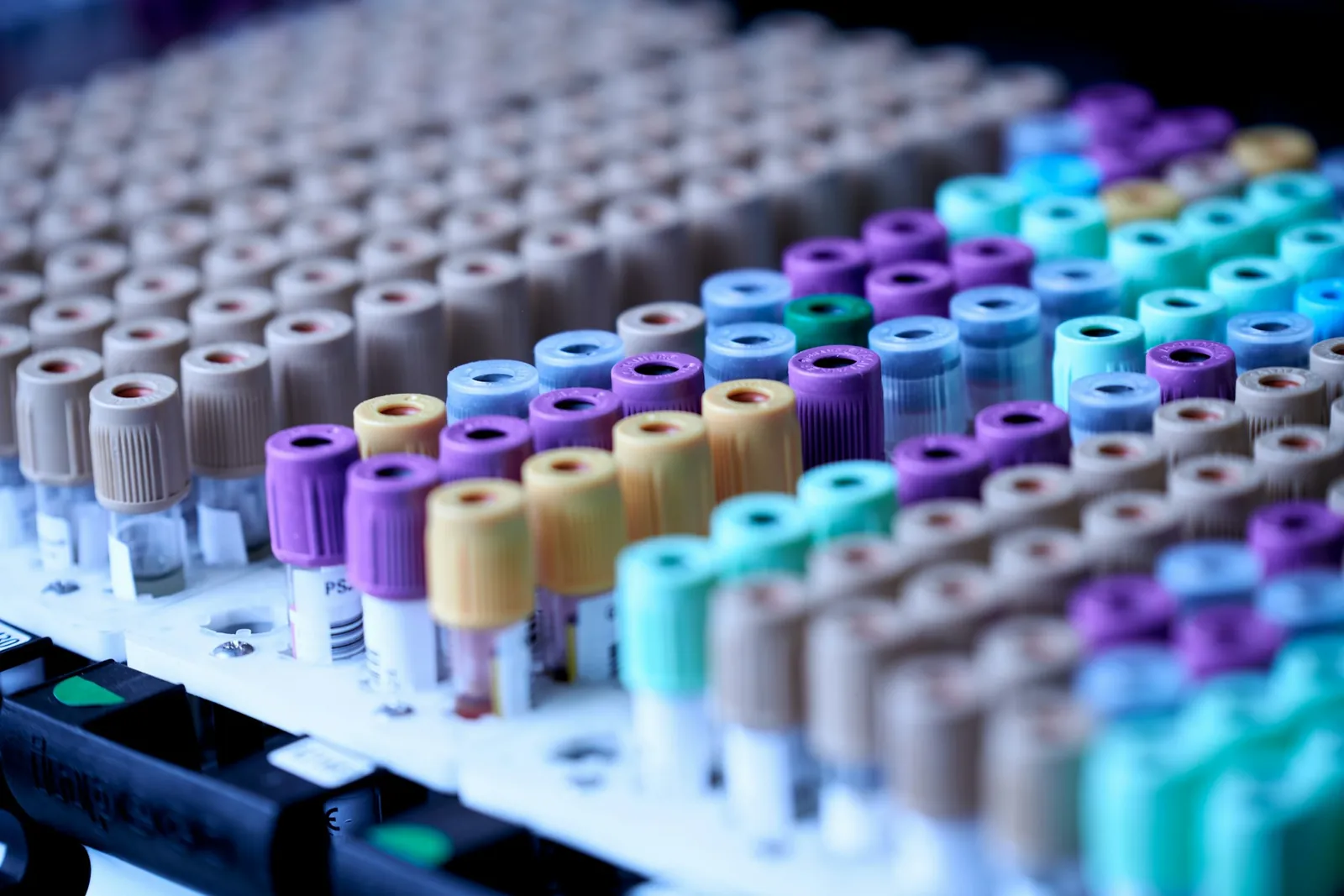 Rows of blood collection tubes in a laboratory rack